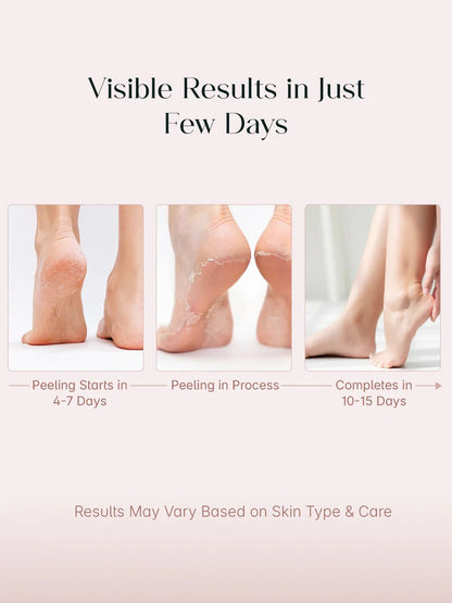 SeoulSkin Soft Feet Peeling Mask