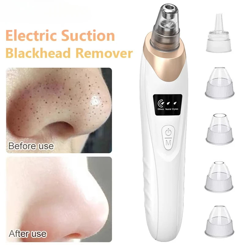 DIVERSE DEPOT™ - Deep Pore Blackhead & Whitehead Remover | Imported Quality