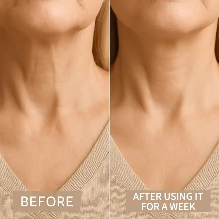 DIVERSE DEPOT™ - Instant Neck Lift & Wrinkle Tape