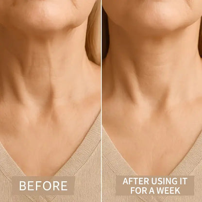 DIVERSE DEPOT™ - Instant Neck Lift & Wrinkle Tape
