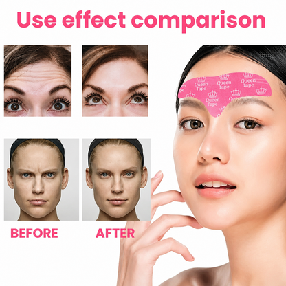 DIVERSE DEPOT™ - Royal Forehead Wrinkle Smoothing Tape