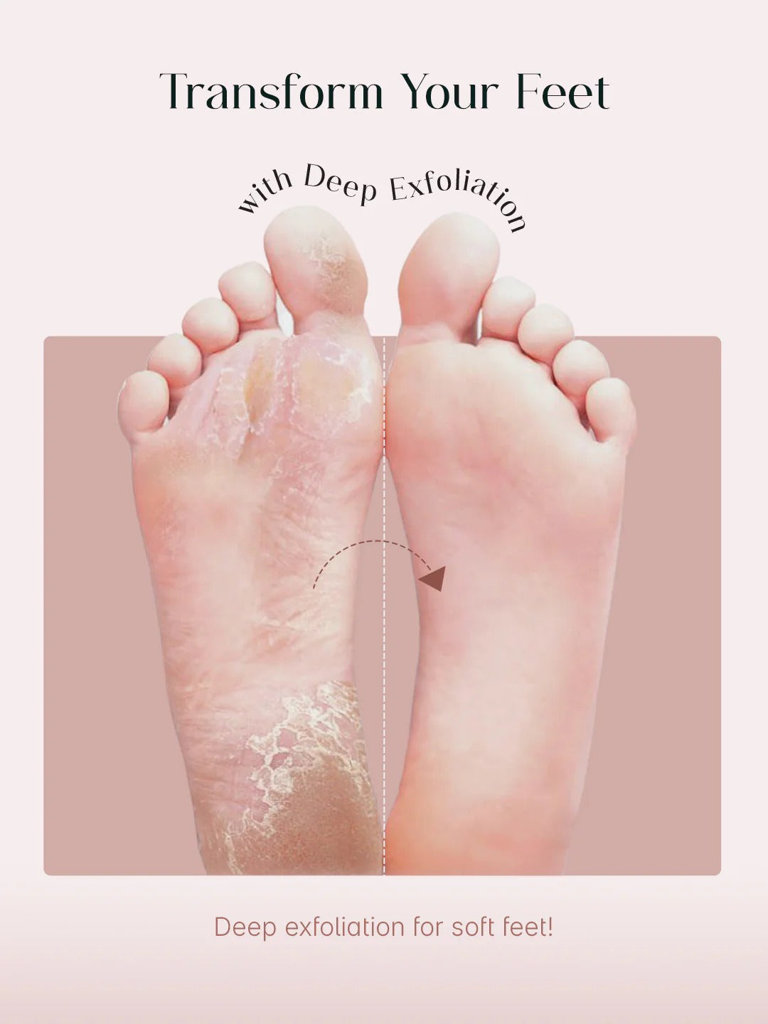 SeoulSkin Soft Feet Peeling Mask