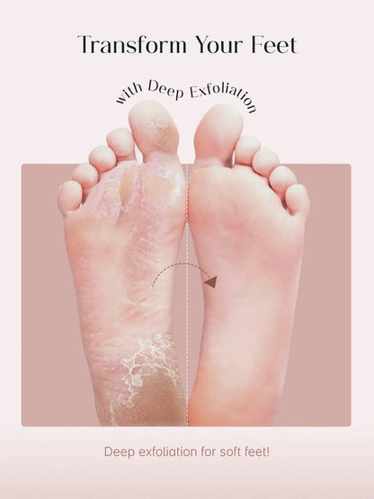 SeoulSkin Soft Feet Peeling Mask