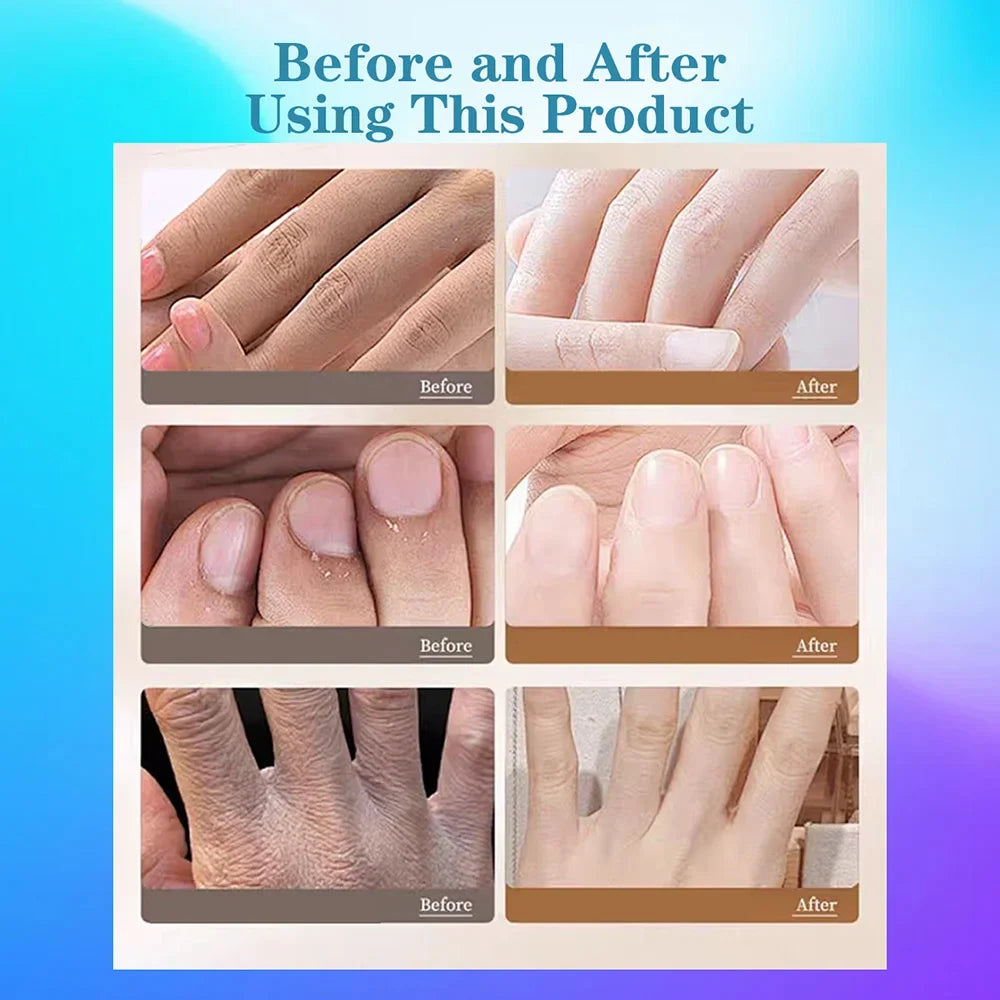 DIVERSE DEPOT™ - 3 Days Damaged Nail Recovery Serum