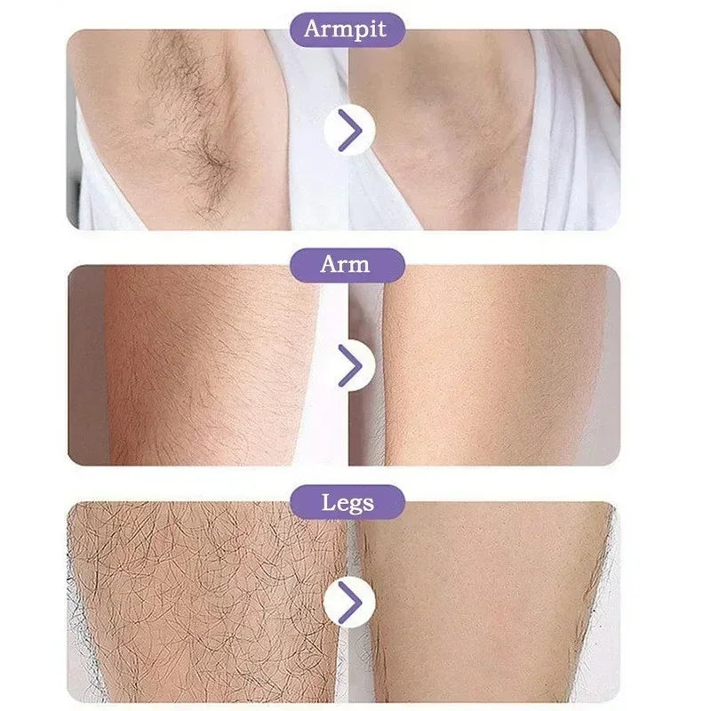 DIVERSE DEPOT™ - Crystal Hair Eraser Painless Remover