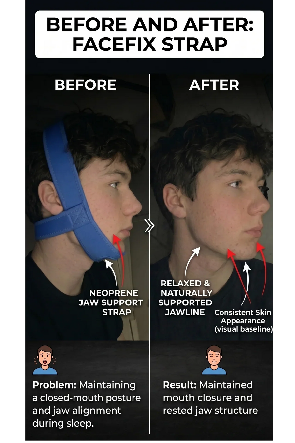 DIVERSE DEPOT™ - Anti Snoring Chin Strap Sleep Support