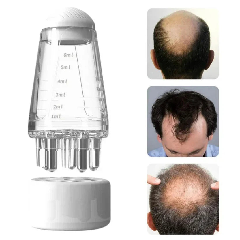 DIVERSE DEPOT™ - Hair Oil Applicator Scalp Massager Bottle