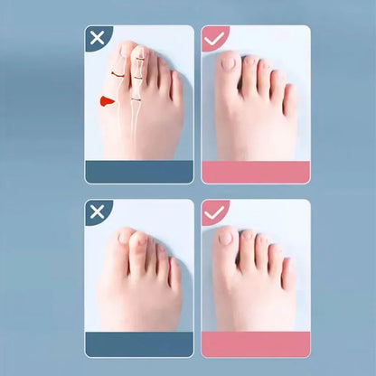 DIVERSE DEPOT™ - Soft Silicone Toe Spacer & Foot Corrector