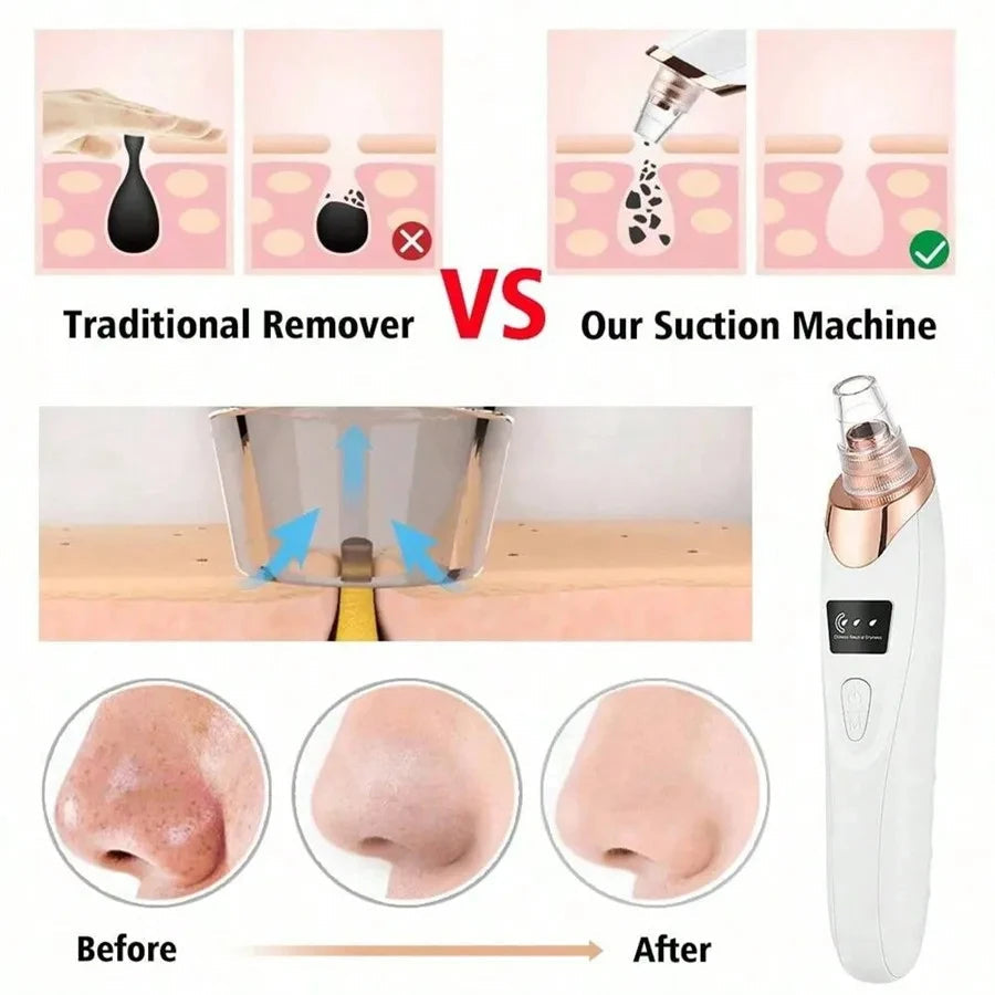 DIVERSE DEPOT™ - Deep Pore Blackhead & Whitehead Remover | Imported Quality