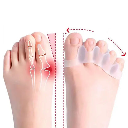 DIVERSE DEPOT™ - Soft Silicone Toe Spacer & Foot Corrector