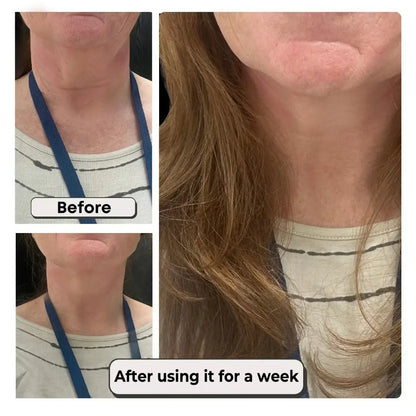 DIVERSE DEPOT™ - Instant Neck Lift & Wrinkle Tape