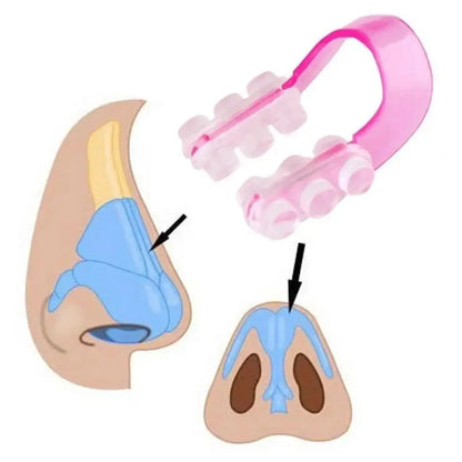 Adjustable Nose Shaping Clip