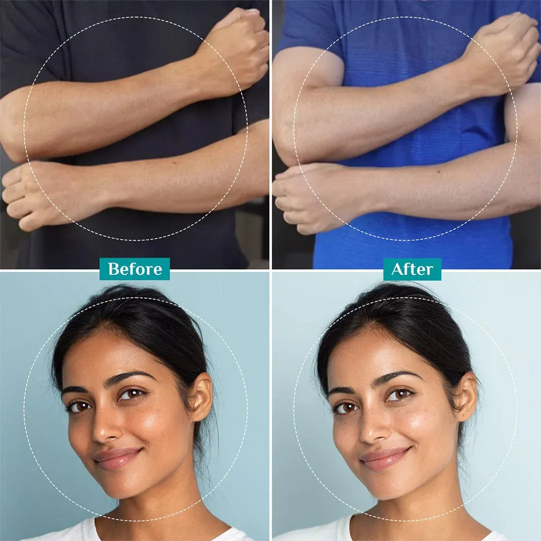 25% AHA, 2% BHA, 5% PHA Peeling Solution for Detan