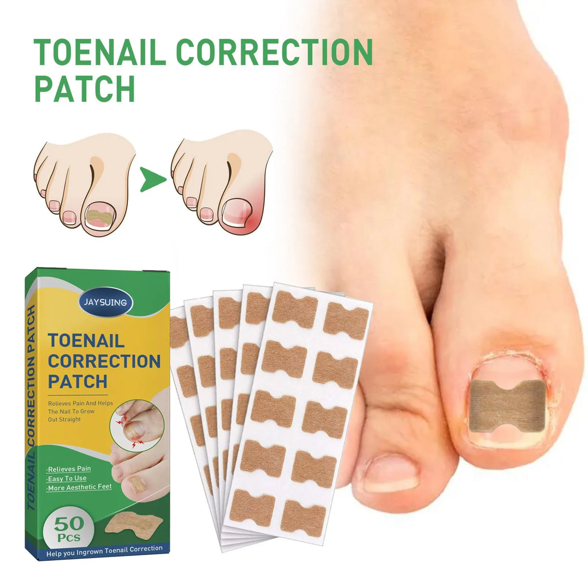 Quick Toe Nail Correction Patches | DIVERSE DEPOT®