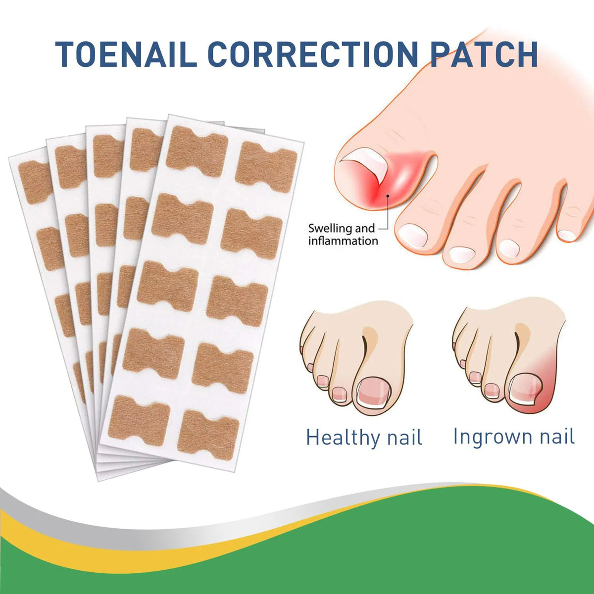 Quick Toe Nail Correction Patches | DIVERSE DEPOT®