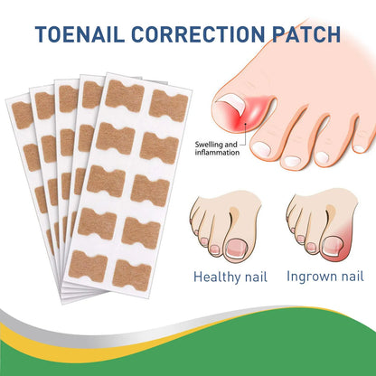 Quick Toe Nail Correction Patches | DIVERSE DEPOT®