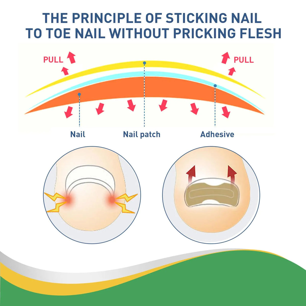 Quick Toe Nail Correction Patches | DIVERSE DEPOT®
