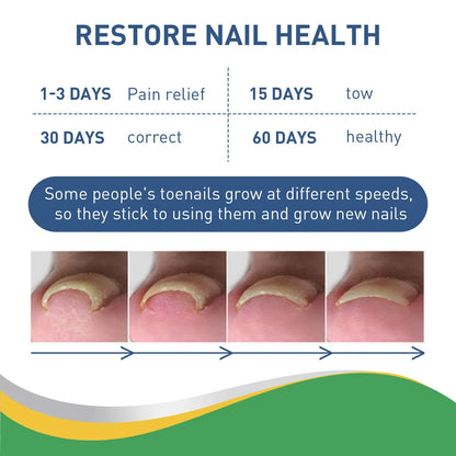 Quick Toe Nail Correction Patches | DIVERSE DEPOT®